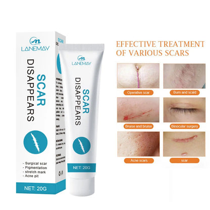 Scar Removal Cream Repair Stretch Marks Burn Acne Surgical Scar Whitening Acne Herbal Beauty Care Ointment Gel